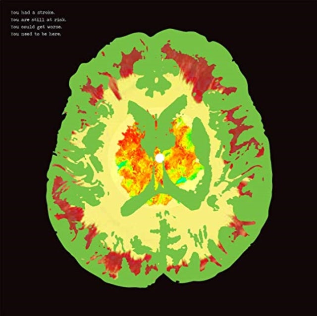 Minus 5 CD - Stroke Manor